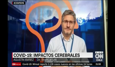 CNN Chile | COVID 19: Impacto cerebrales